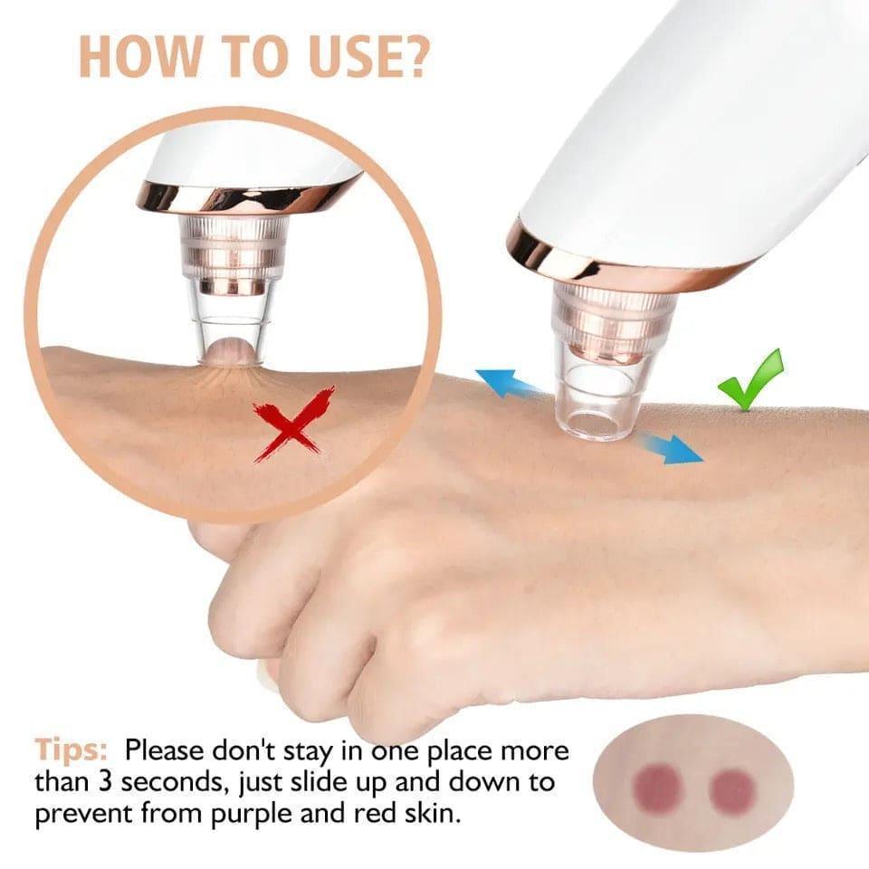 WHITENING BLACK HEAD REMOVER